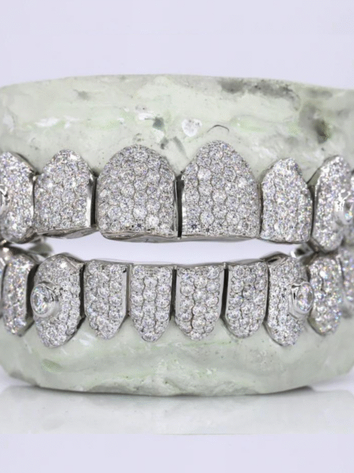 925 Silver VVS Moissanite Iced Out Teeth Grillz
