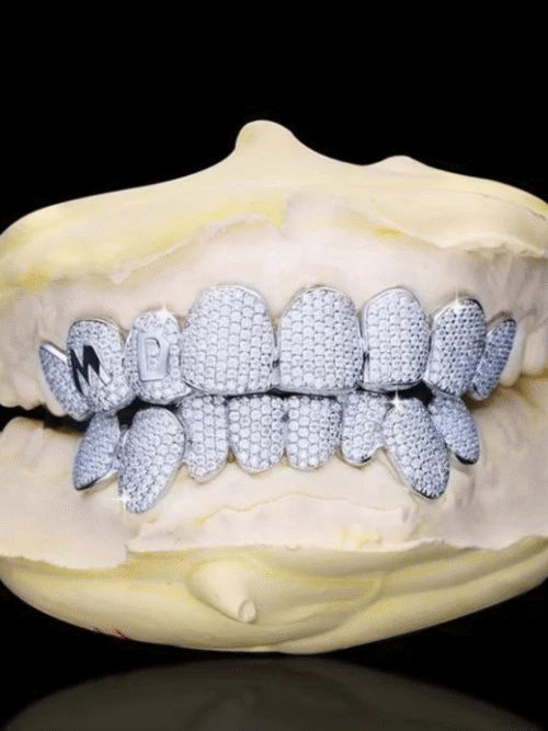 925 Silver VVS Moissanite Iced Out Teeth Grillz