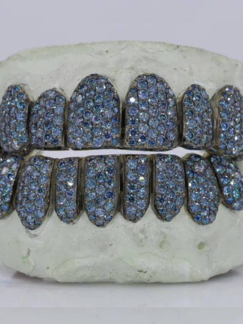 925 Silver VVS Moissanite Iced Out Teeth Grillz