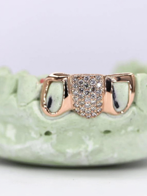 925 Silver VVS Moissanite Iced Out Teeth Grillz
