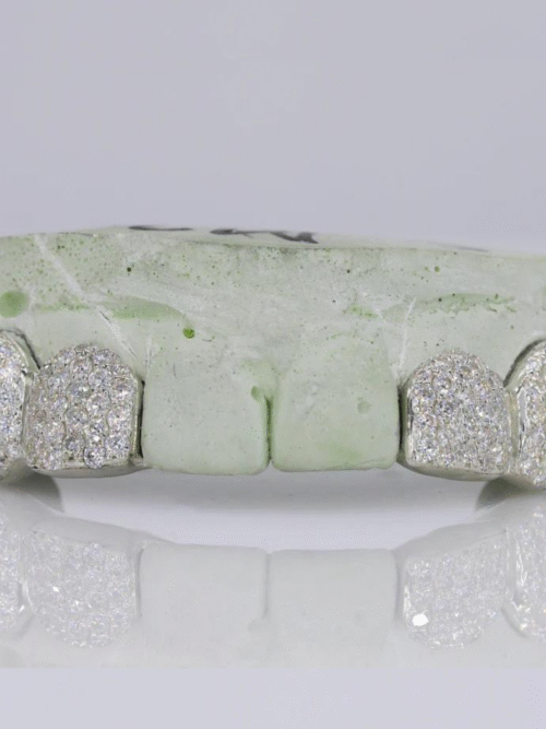 925 Silver VVS Moissanite Iced Out Teeth Grillz